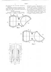 Эндопротез плечевого сустава (патент 1526684)