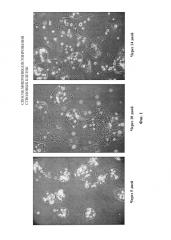 Способ микроинкапсулирования стволовых клеток (патент 2618435)