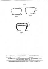 Зубная коронка (патент 1814543)