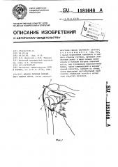 Способ лечения привычного вывиха плеча (патент 1181648)