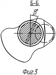 Коленчатый вал двигателя внутреннего сгорания (патент 2335668)