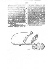 Способ наложения шва на ткань печени (патент 1818084)