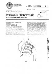 Устройство в.в.василенкайтиса для разгрузки сустава (патент 1316666)