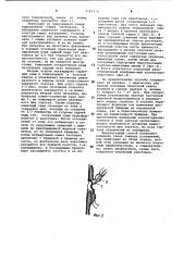 Способ наложения колоэнтероанастомоза (патент 1142110)