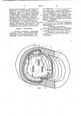 Шахтная перемычка (патент 985315)