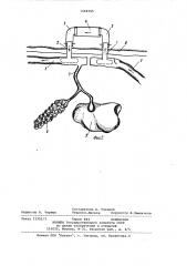 Способ создания внешнего анастомоза на двенадцатиперстной кишке у животных (патент 1068105)
