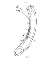 Интубационная трубка (патент 1217422)
