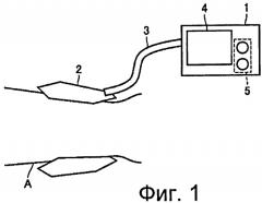 Электронный манометр для надлежащего регулирования внутреннего давления манжеты и способ управления им (патент 2408257)