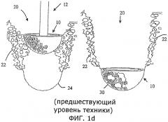 Кожух чашки, предотвращающий попадание на нее мягких тканей (патент 2556521)