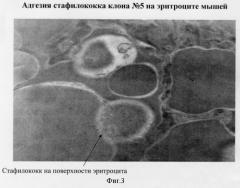 Способ прогнозирования развития анемии при гнойно-воспалительных заболеваниях (патент 2296336)