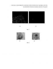 Способ селективного лазерного фототермолиза раковых клеток плазмонно-резонансными наночастицами (патент 2653801)