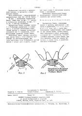 Медицинская банка (патент 1391655)