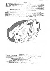 Защитные очки (патент 935100)