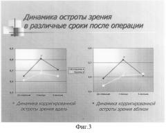 Способ модифицированной субпороговой панмакулярной микрофотокоагуляции сетчатки при диабетическом макулярном отёке (патент 2308920)