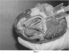 Способ исследования анатомии коронарного русла изолированных сердец млекопитающих (патент 2308971)