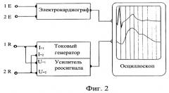 Способ неинвазивного мониторирования сократительной способности миокарда (патент 2293515)