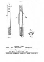 Фиксатор шейки бедренной кости (патент 1311729)
