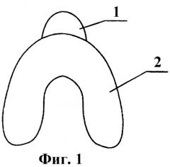 Индивидуальная ложка куретовых для снятия оттиска на беззубую челюсть (два варианта) (патент 2481804)
