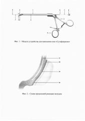 Устройство для доставки клея 