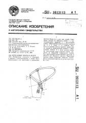 Крепление протеза бедра (патент 1613113)