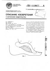 Способ закрытия костной полости (патент 1119677)