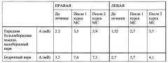 Способ восстановления функции нервов (патент 2662657)