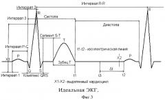 Способ выделения начала кардиоцикла (патент 2359606)