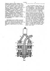 Узел крепления концов каната (патент 1551883)