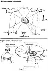 Устройство для регистрации электрокардиосигналов (патент 2258457)