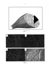 Способ стимуляции регенерации мышечной ткани (патент 2597838)
