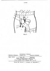 Электродное устройство для исследования яичка (патент 1219096)
