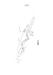 Катетер со спиралевидной концевой секцией для абляции сосудов (патент 2633327)