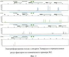 Способ пренатальной и постнатальной днк-диагностики синдрома дауна, эдвардса, патау, мутации delf508 в гене муковисцидоза и резус-фактора плода (патент 2539778)