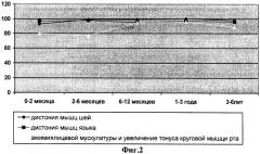 Способ ранней диагностики логопедических, ортодонтических и оттолярингологических нарушений (патент 2310433)