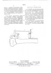 Устройство для определения перемещений костных отломков (патент 649417)