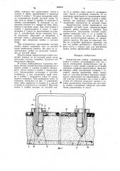 Хирургическая скобка (патент 982676)