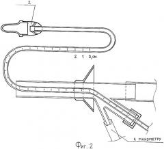 Ректальный катетер (патент 2306154)