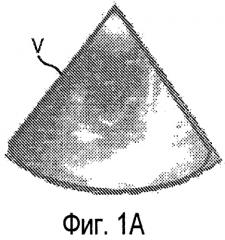 Способ и устройство для формирования трехмерного ультразвукового изображения (патент 2436514)