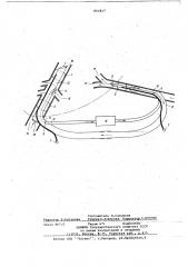 Катетер (патент 651817)