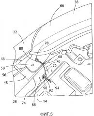 Тросовое устройство для ограничения перемещения фары при фронтальных ударах на низкой скорости (патент 2660161)