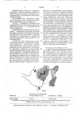 Устройство для остеосинтеза (патент 1764643)