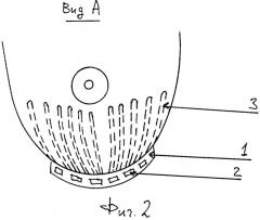 Имплантант для поддержания молочной железы (патент 2332188)