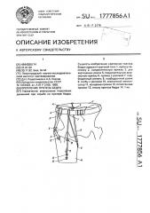 Крепление протеза бедра (патент 1777856)