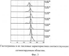 Способ диагностики патологии околоносовых пазух путем распознавания образов (патент 2585700)