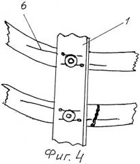 Способ и устройство для лечения множественных переломов ребер и грудины (патент 2503424)
