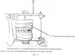 Способ конструирования протетической плоскости (патент 2573555)