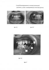 Способ безоперационного лечения мезиальной окклюзии у детей с незавершённым скелетным ростом (патент 2593234)