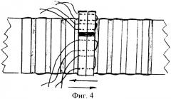 Способ формирования анастомоза трахеи (патент 2382608)