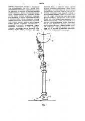 Протез после вычленения бедра (патент 1600758)