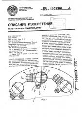 Соединение ступицы с валом (патент 1059304)